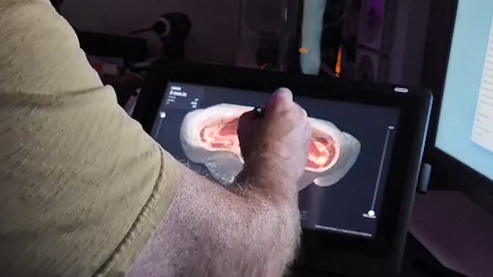 Turning an axial section with the pen