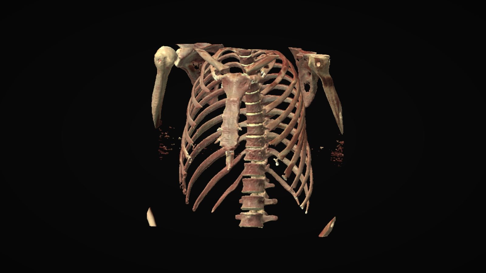 The skeleton
