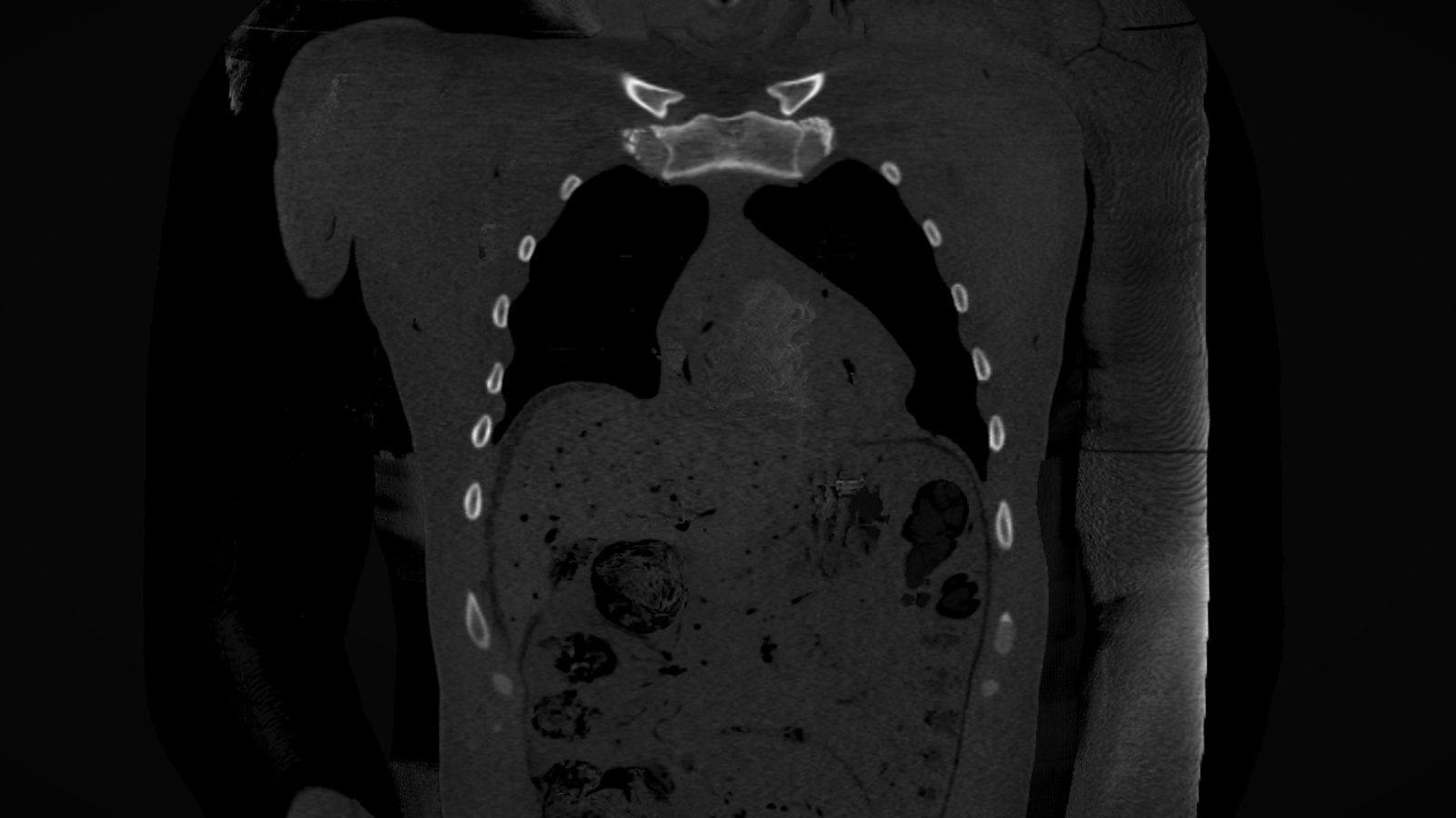 The same body as CT