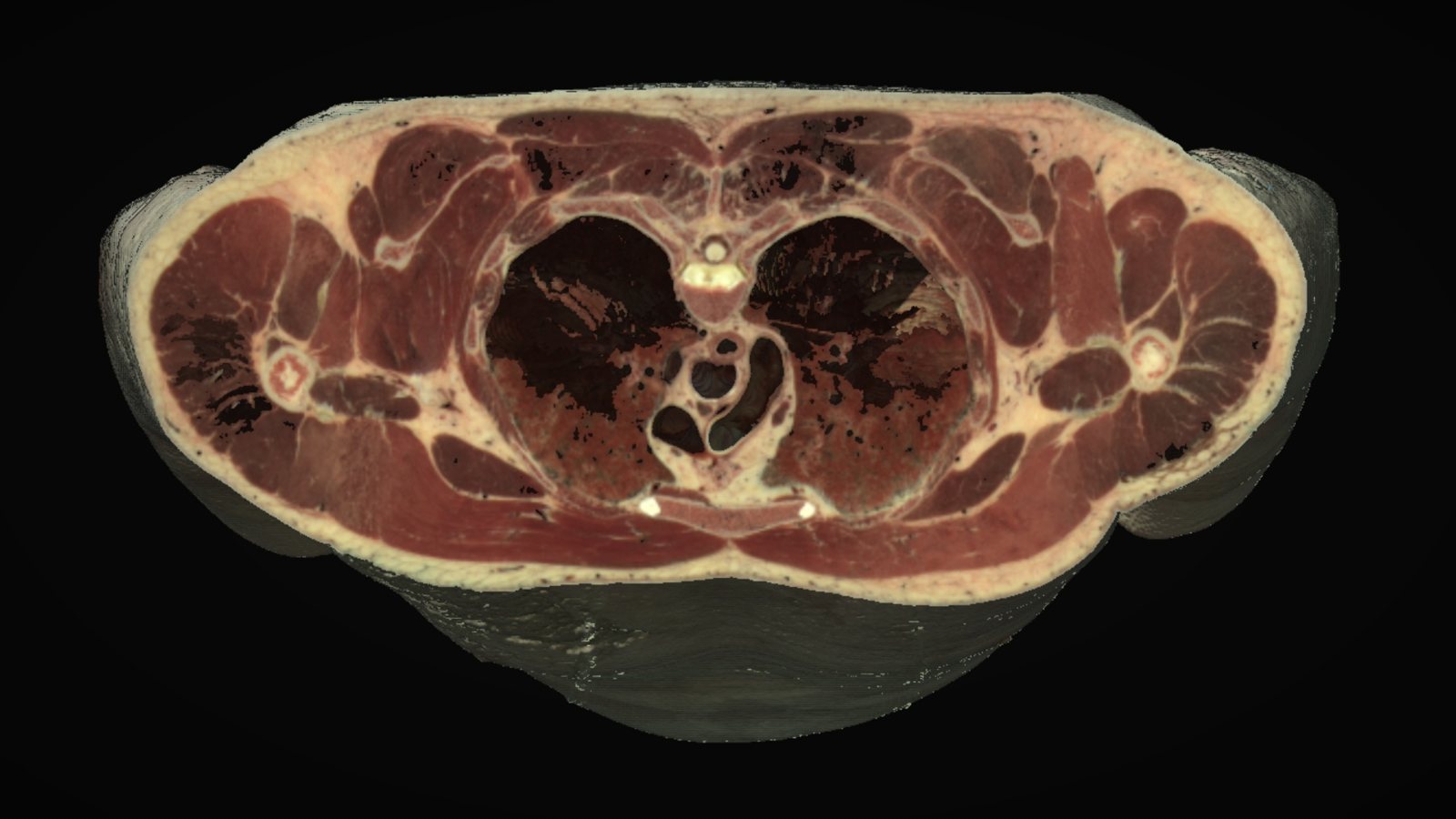 An axial section of the chest